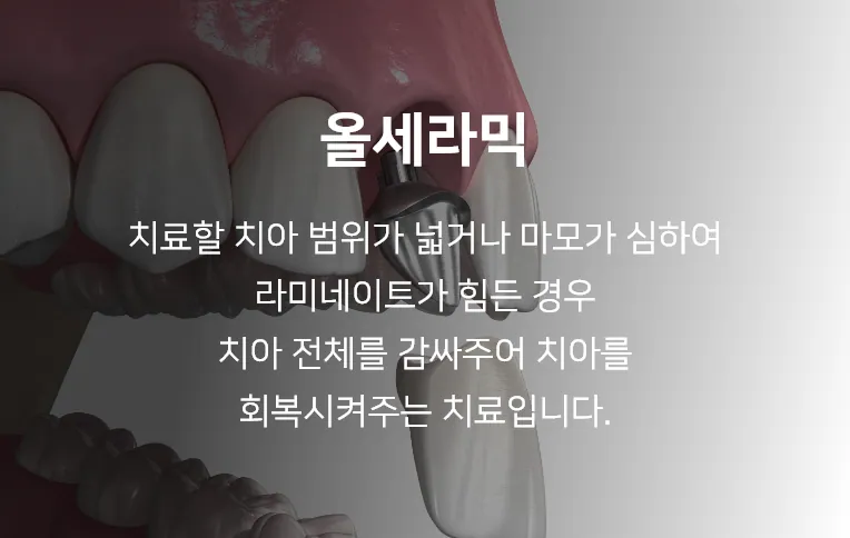 안양치과 정성치과의원 보철치료