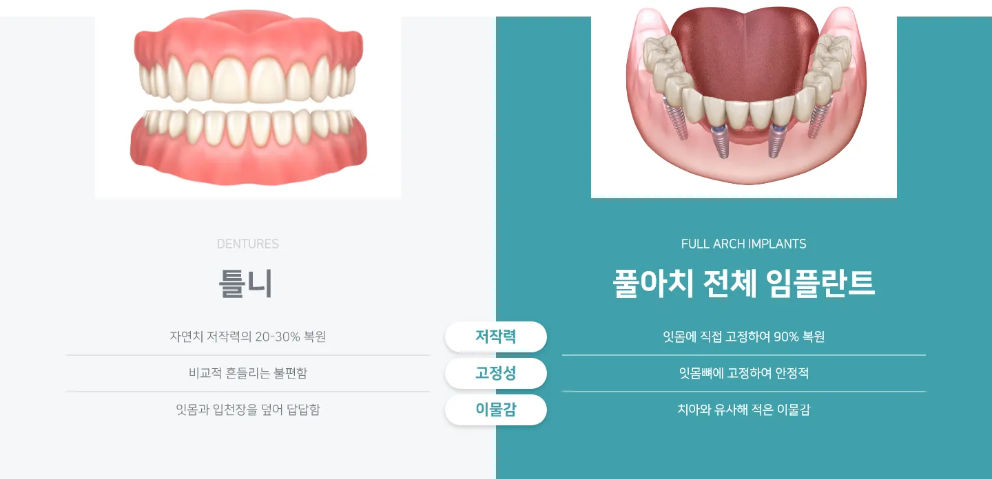 범계역 안양정성치과 임플란트