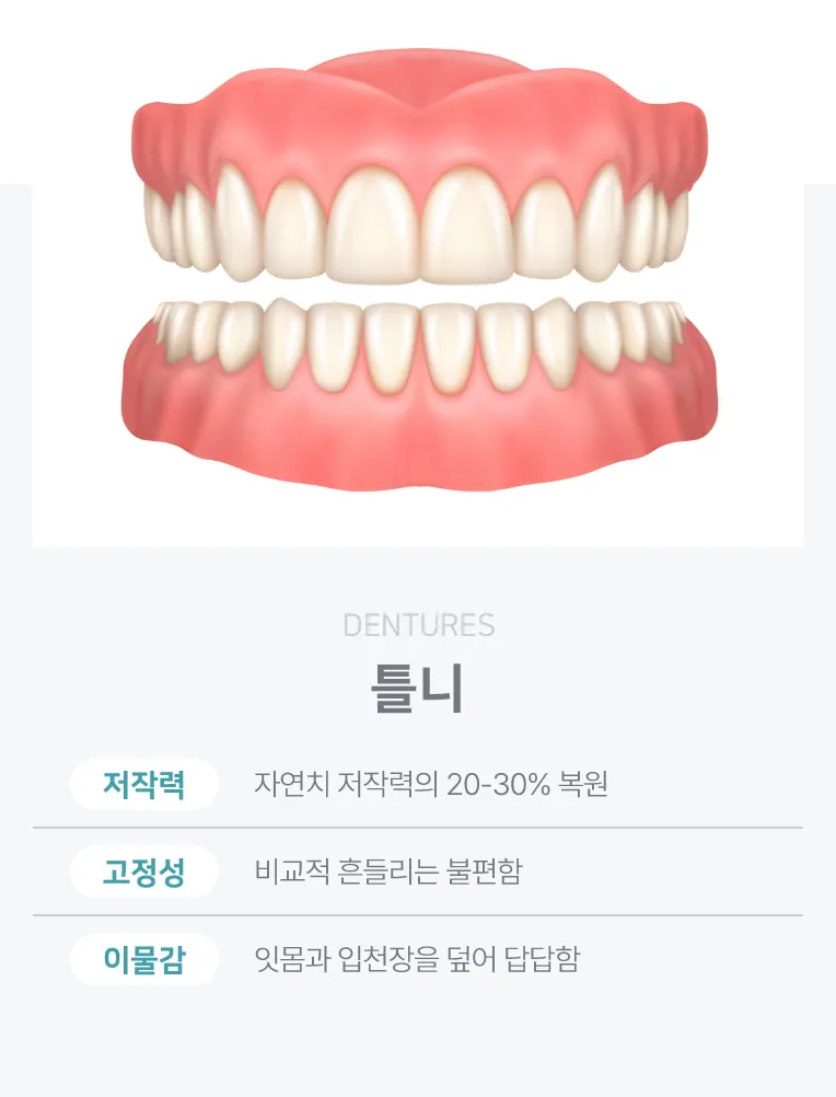 범계역 안양정성치과 임플란트